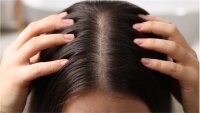 Elkaderm Neutrea 5% Urea Shampoo 250 ml