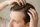 Elkaderm Neutrea 5% Urea Shampoo 250 ml